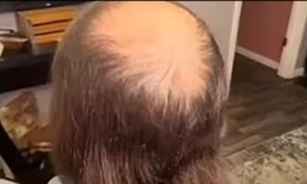 Balding man unrecognisable after sister gives him ‘amazing’ transformation as new admirers say ‘he’s gorgeous!’