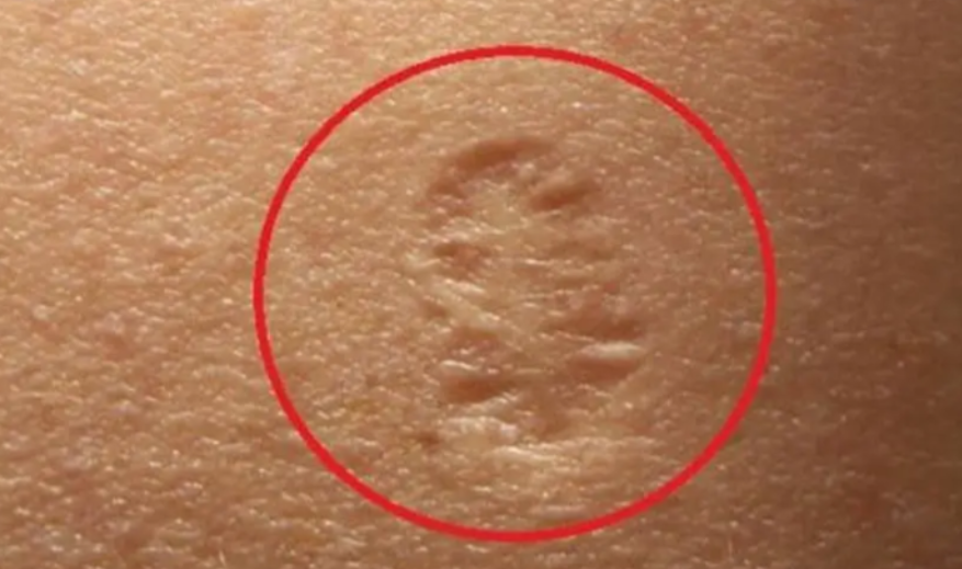 Do you know the truth behind the small scar on the upper left arm and its real meaning