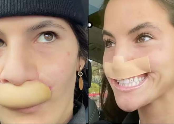 Model whose lip was bitten off by dog shows off transformation after six surgeries