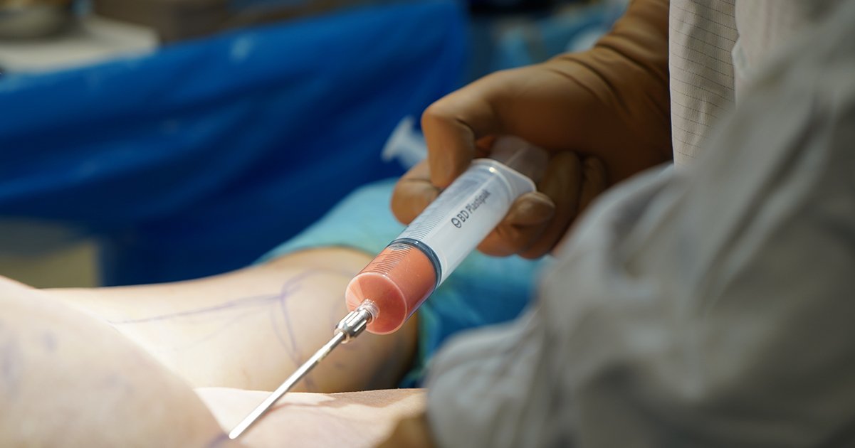 Botched BBL surgery leaves Florida woman permanently disabled