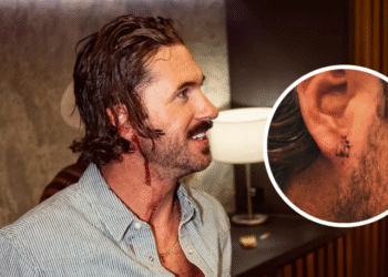 Riley Green Receives Stitches After Incident With Fan In Australia