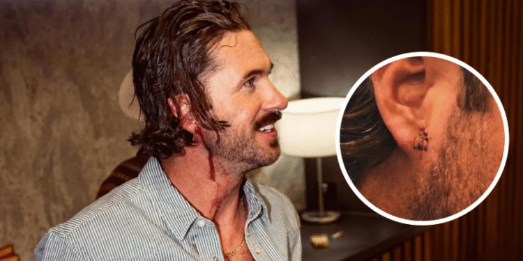 Riley Green Receives Stitches After Incident With Fan In Australia