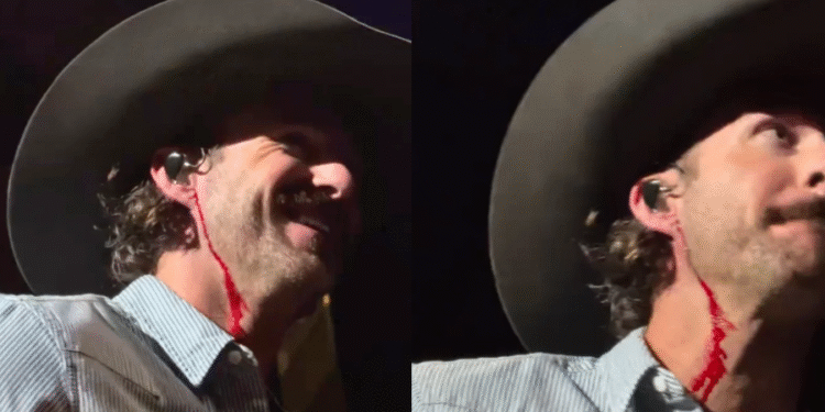 Riley Green Left Bleeding From Neck After Fan Throws Object